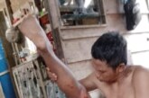 Selamat dari Maut, Seorang Warga Diserang Buaya Saat Memancing