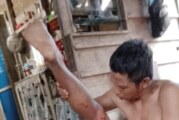 Selamat dari Maut, Seorang Warga Diserang Buaya Saat Memancing
