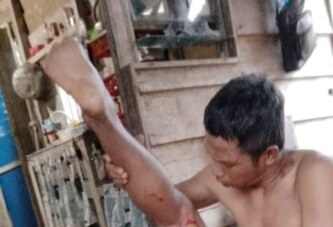 Selamat dari Maut, Seorang Warga Diserang Buaya Saat Memancing
