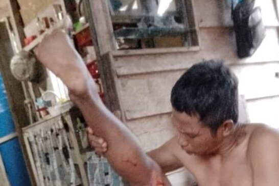 Selamat dari Maut, Seorang Warga Diserang Buaya Saat Memancing